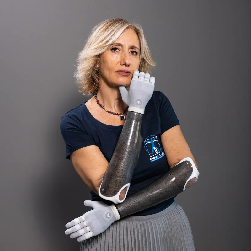 Frau mit myoelektrischer Armprothese Adams Hand – moderne Prothetik für natürliche Bewegung und Alltagssicherheit