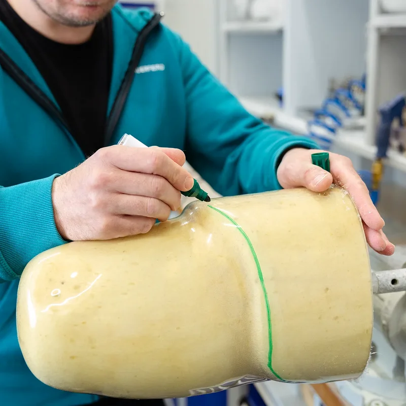 Anzeichnen eines Prothesenmodells zur Anpassung – präzise Vorbereitung für passgenaue Prothetikfertigung bei Uniprox