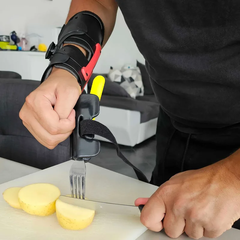 Person mit macu4 Armprothese schneidet Kartoffeln – präzise Greiffunktion und sichere Anwendung im Alltag