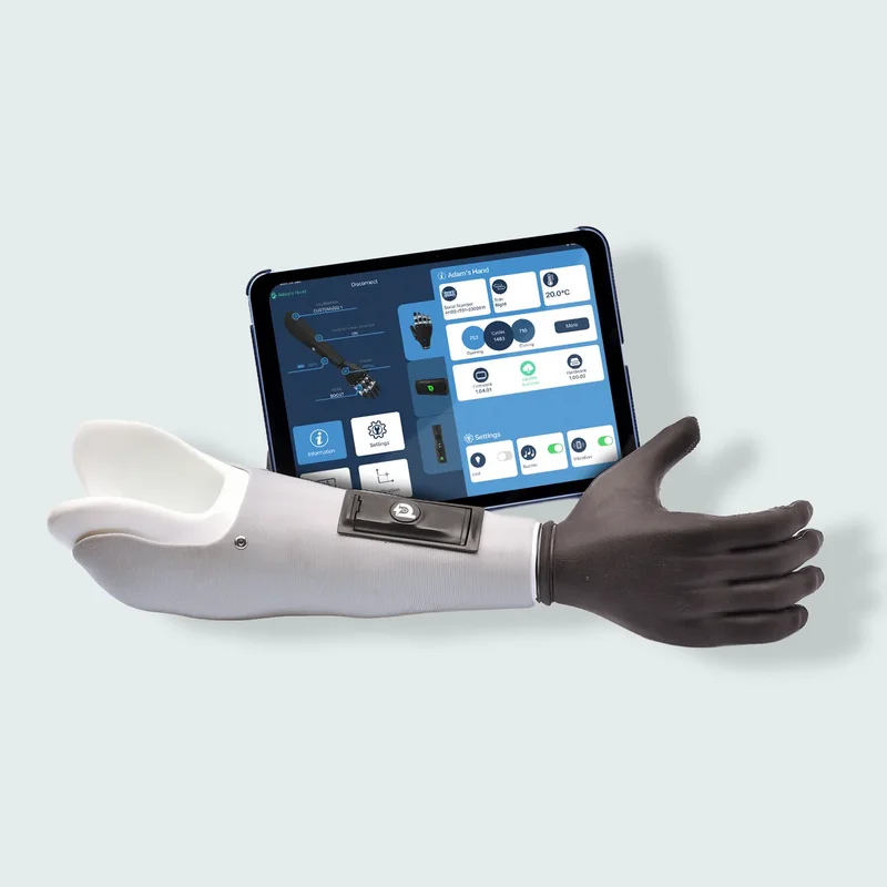 Myoelektrische Handprothese neben Tablet – präzise Steuerung und moderne Prothetik für Alltag und digitale Nutzung
